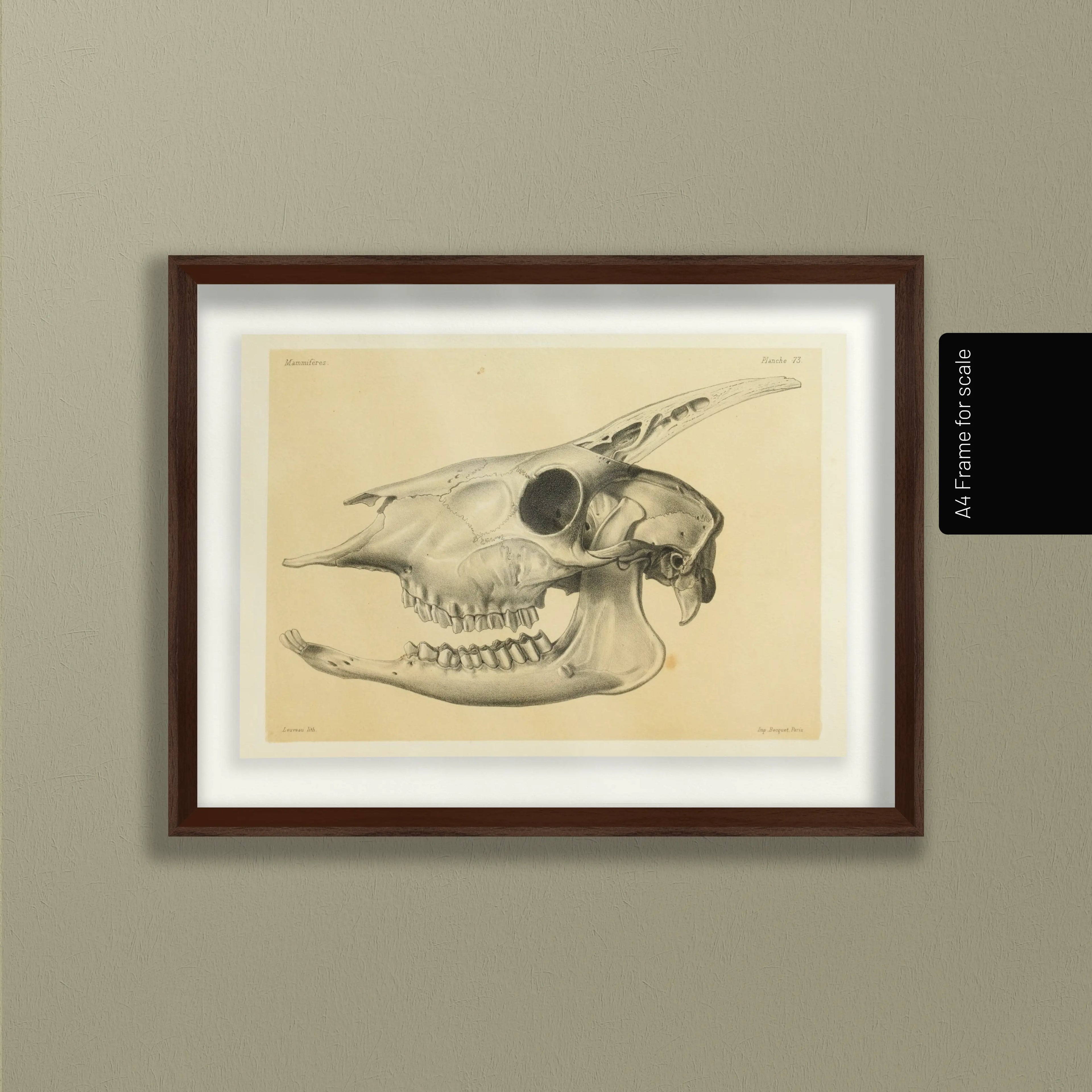 Anatomy: Plate No. 47