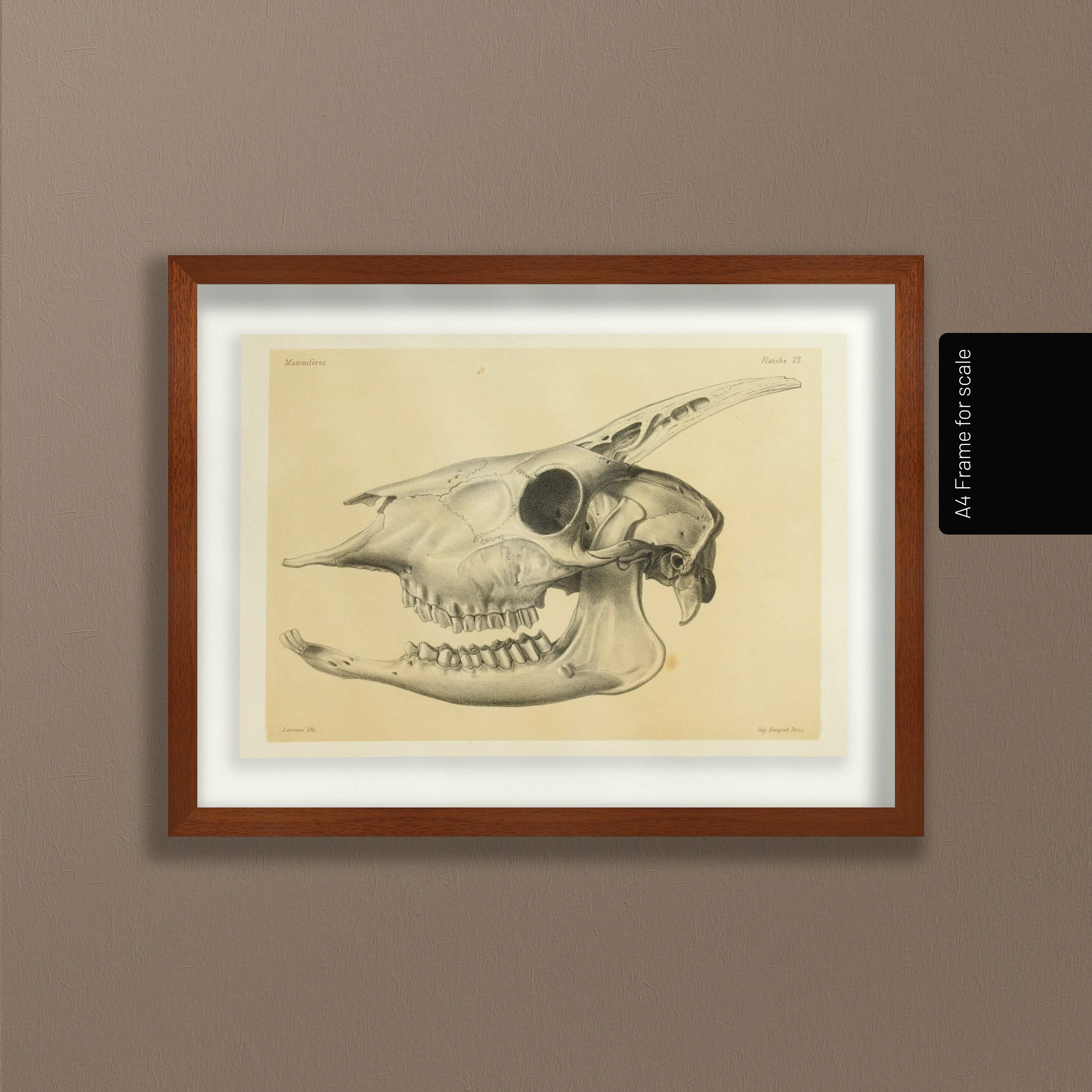 Anatomy: Plate No. 47