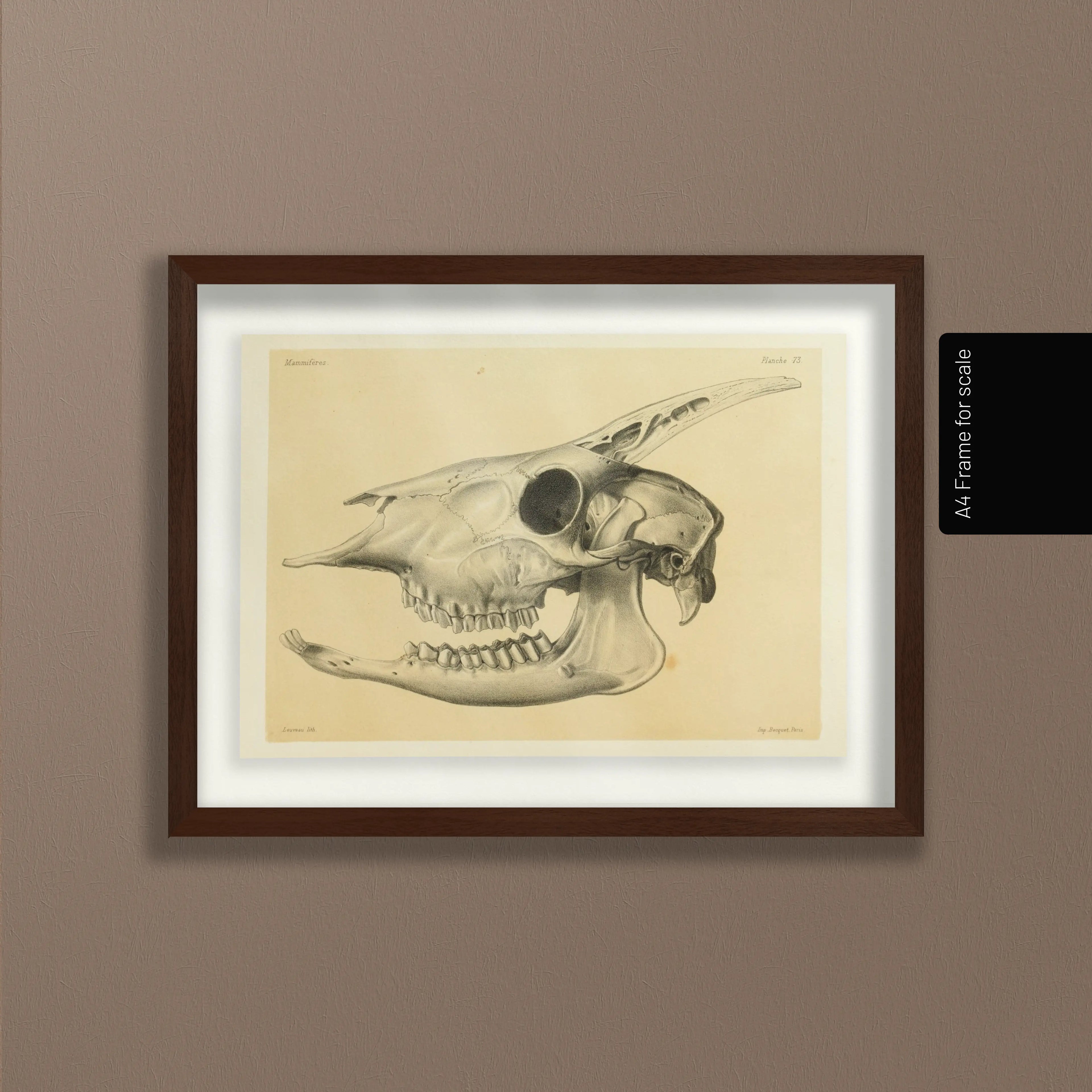 Anatomy: Plate No. 47