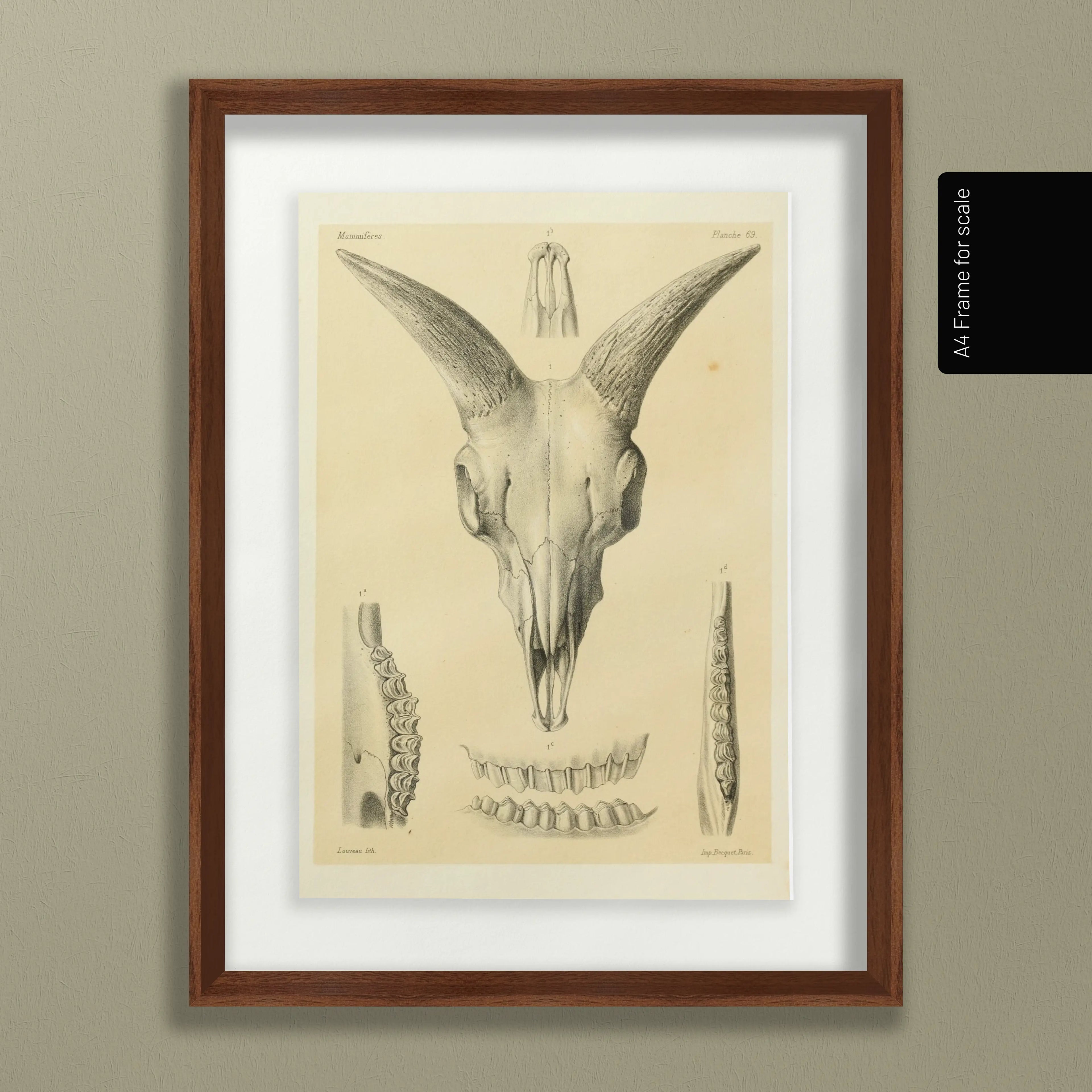 Anatomy: Plate No. 49