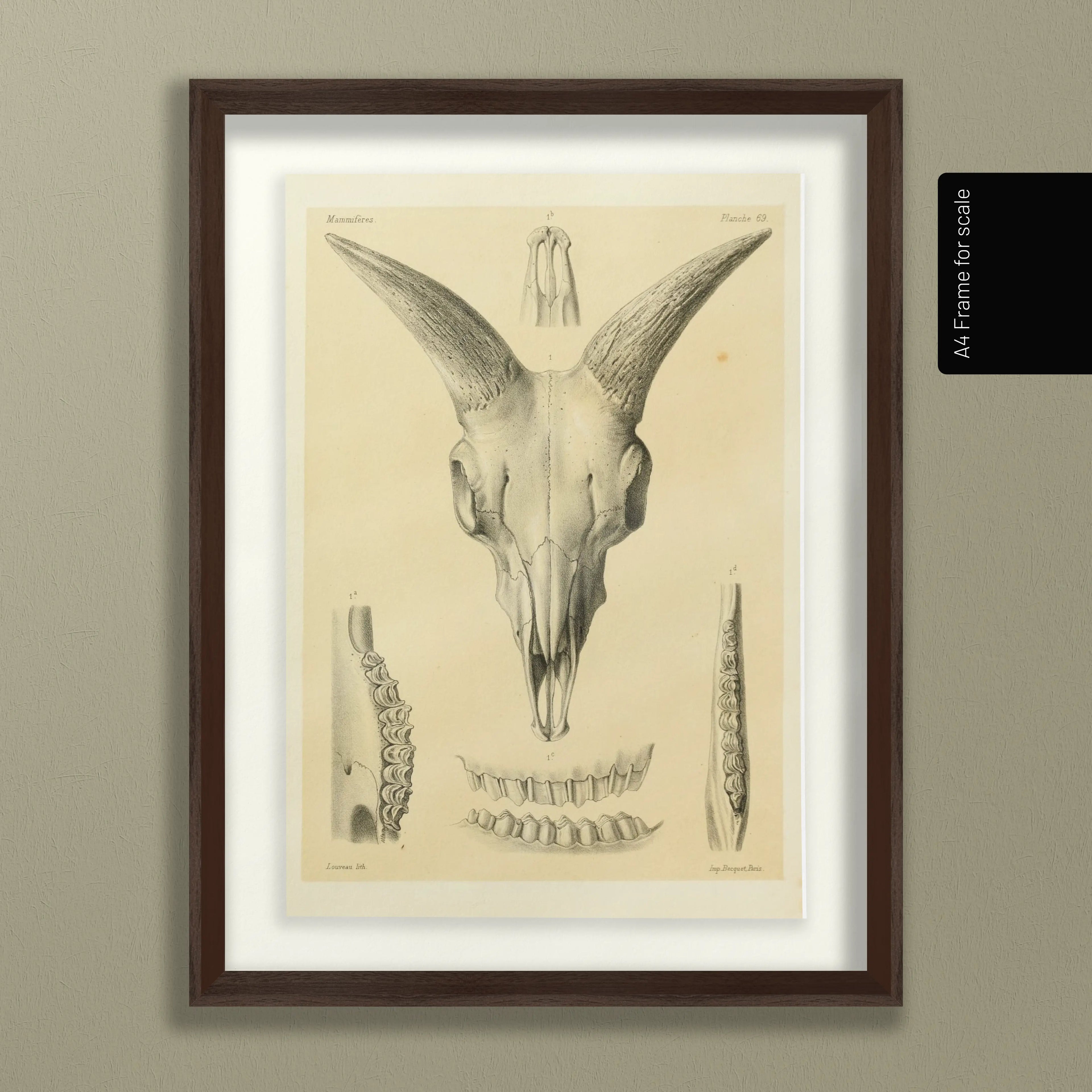 Anatomy: Plate No. 49