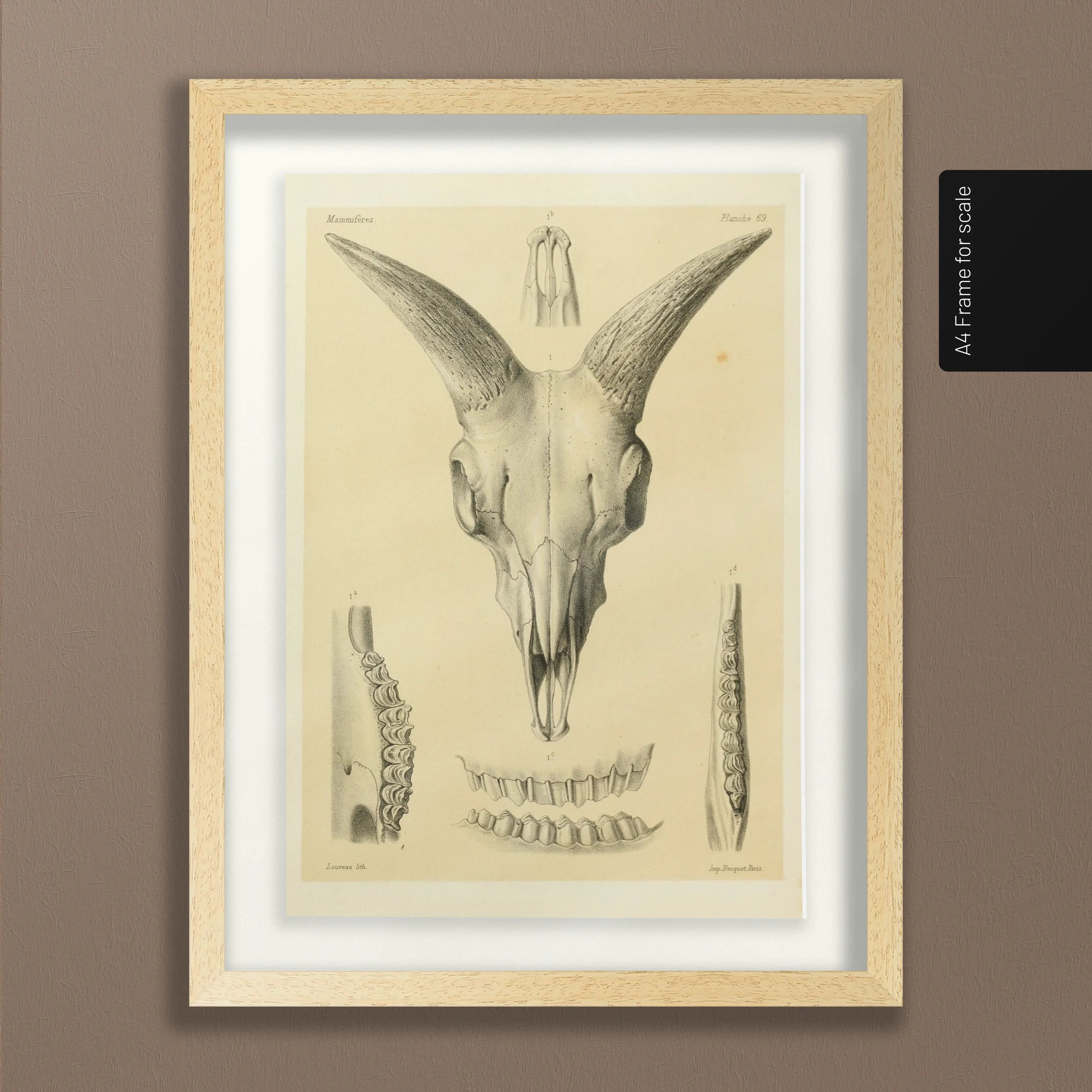 Anatomy: Plate No. 49