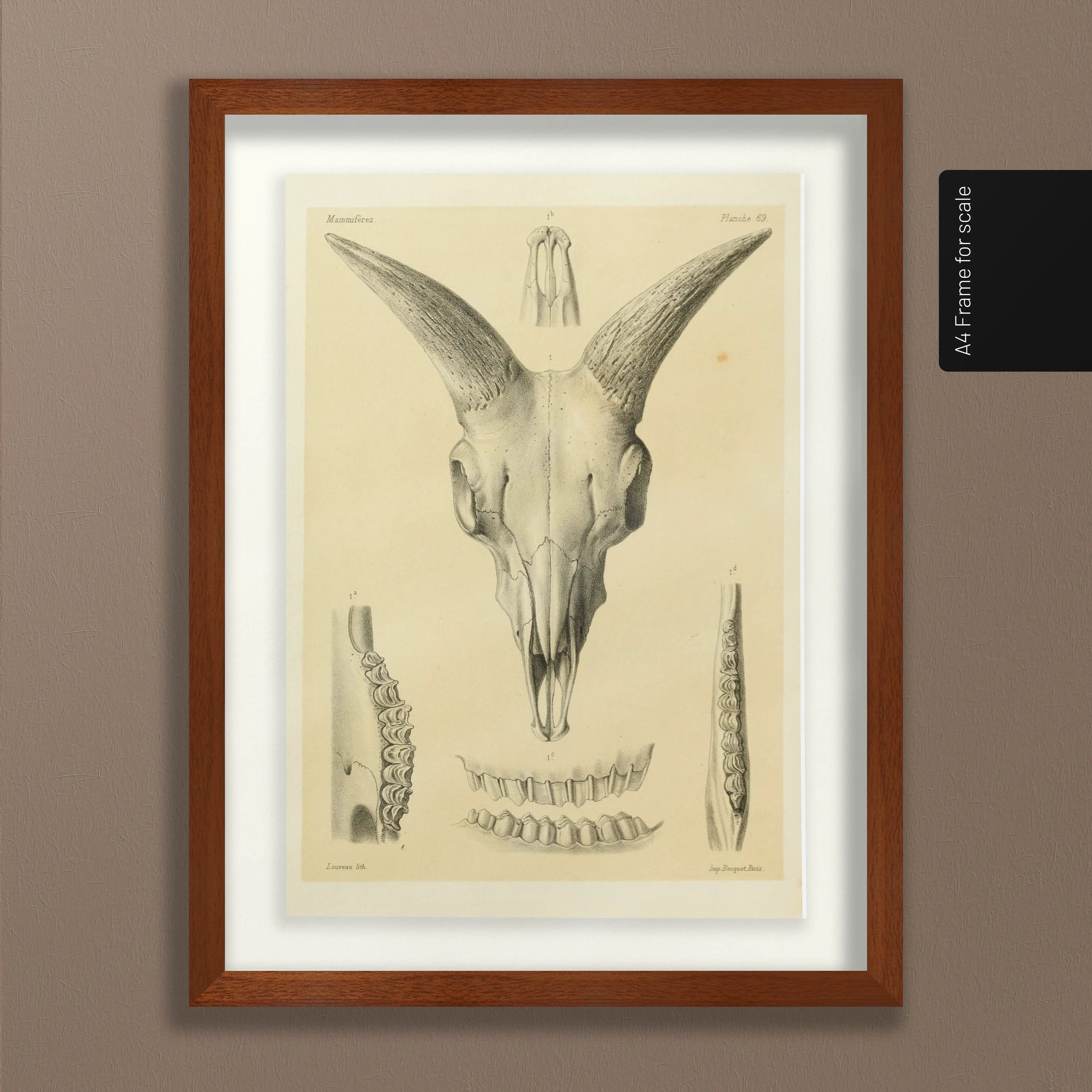 Anatomy: Plate No. 49