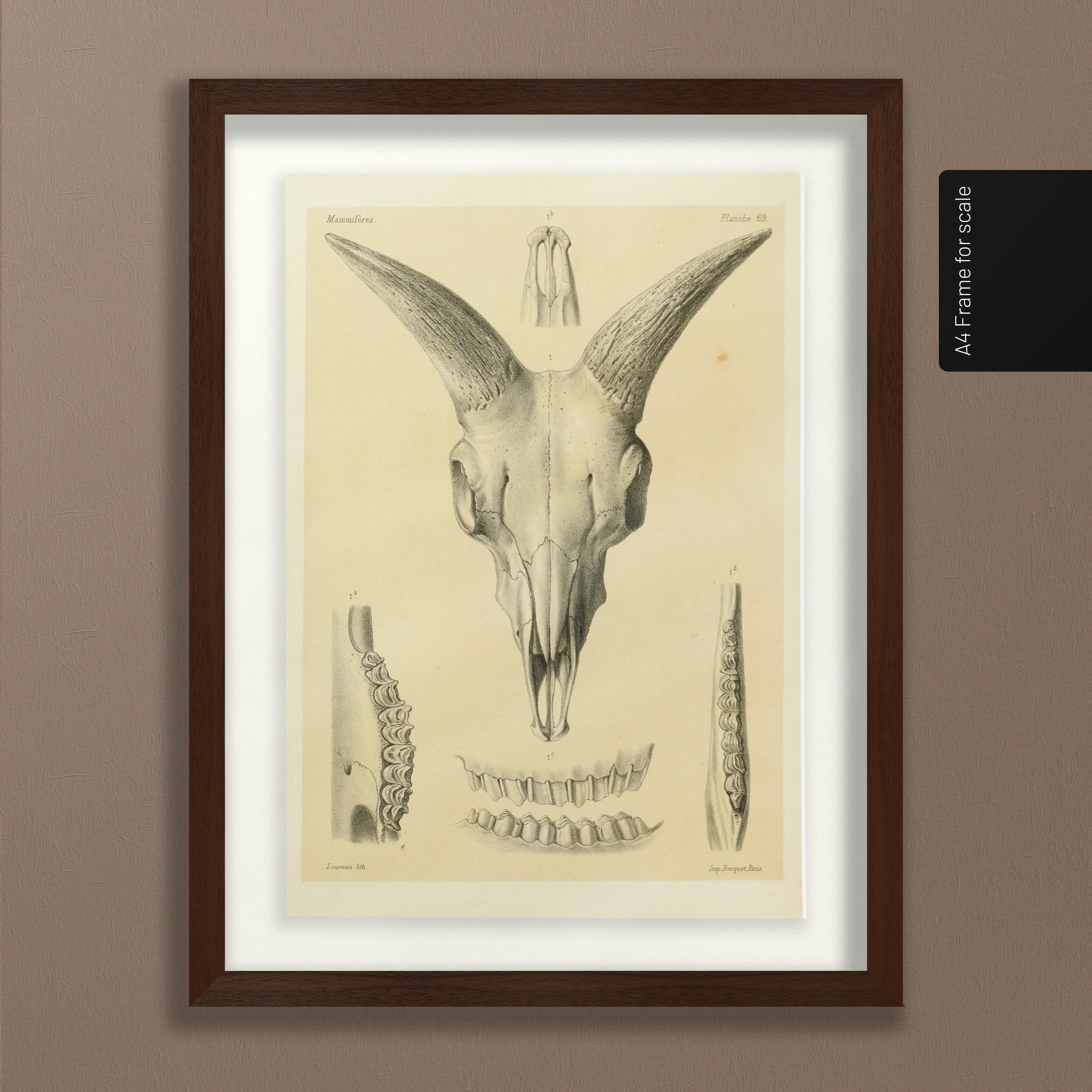 Anatomy: Plate No. 49