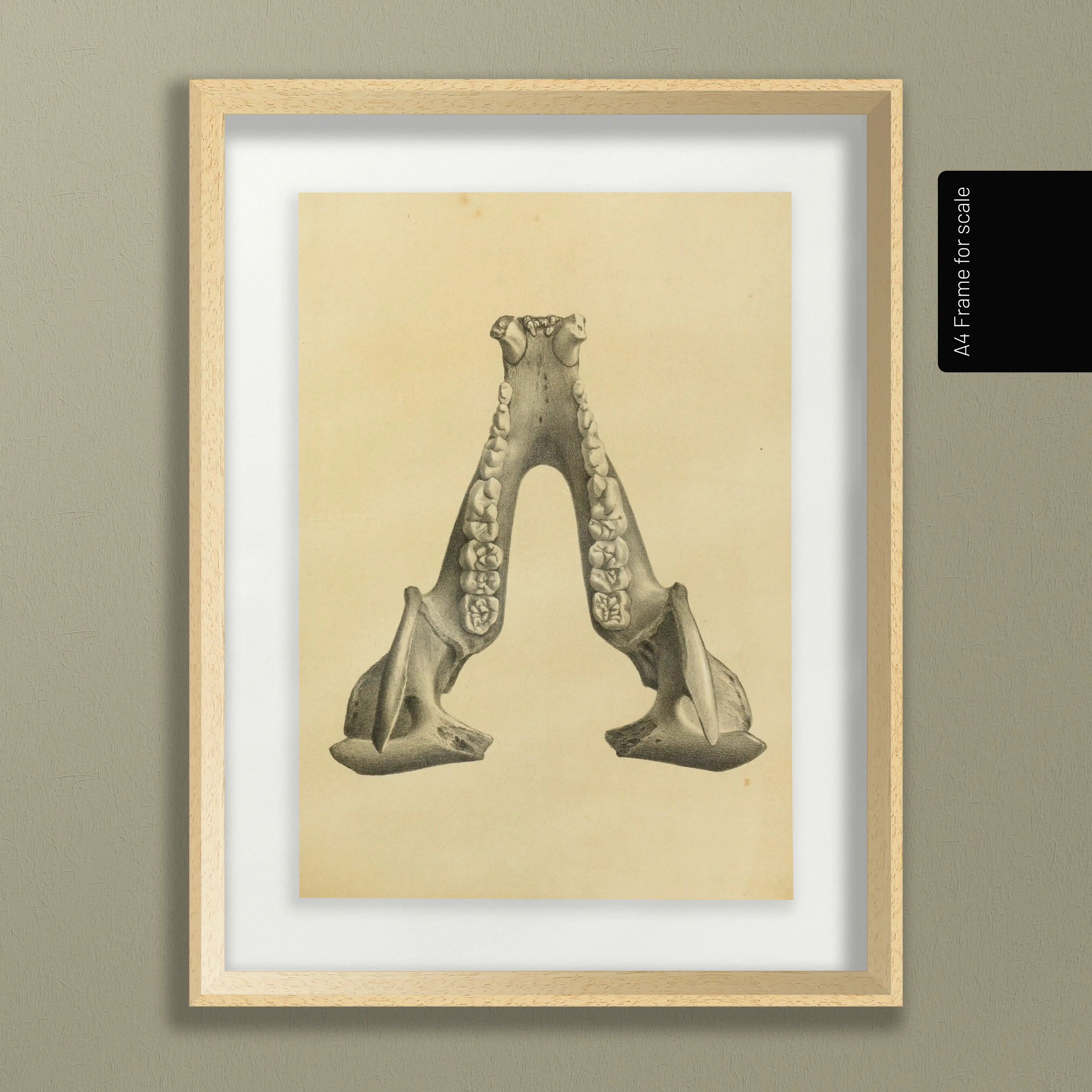 Anatomy: Plate No. 52