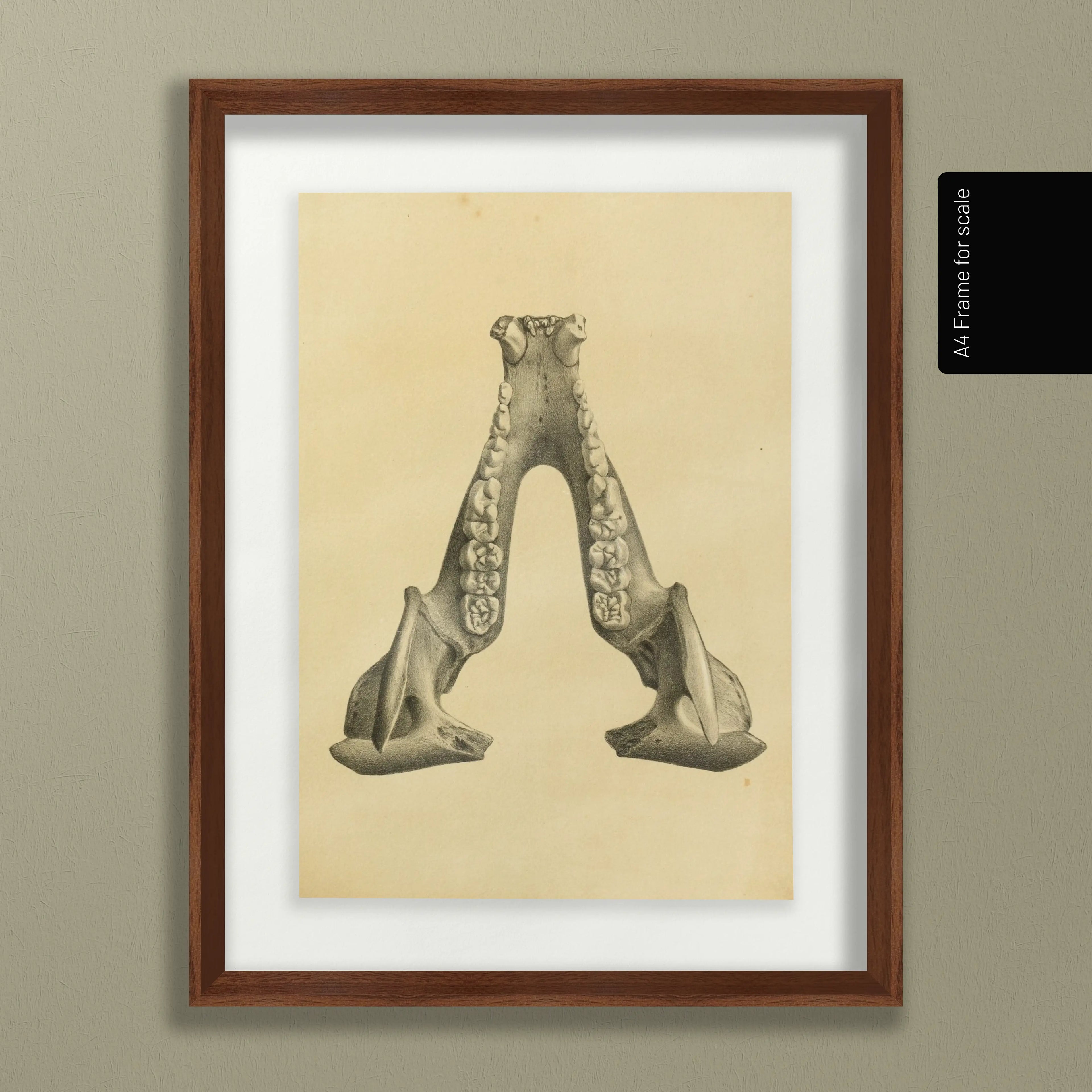 Anatomy: Plate No. 52