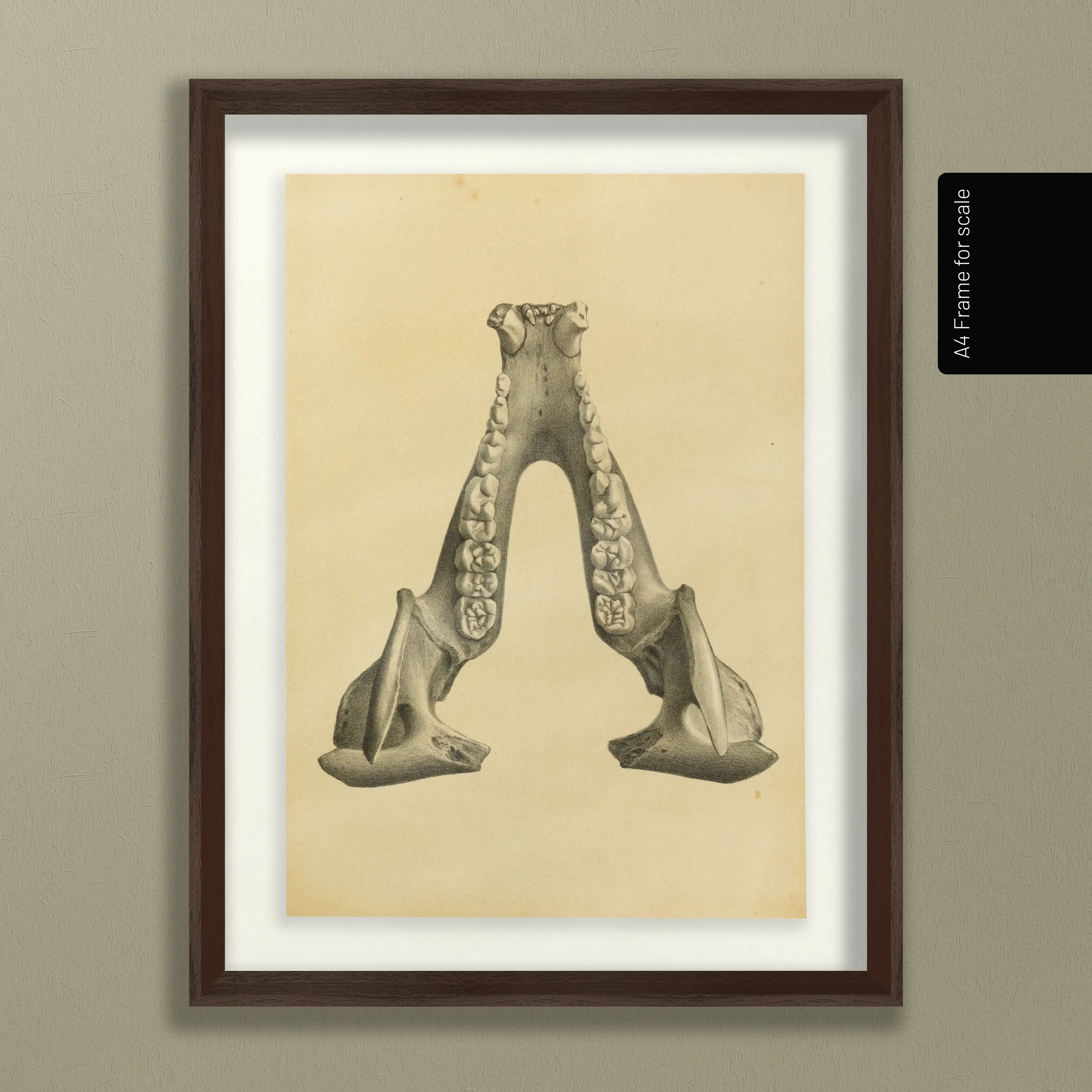 Anatomy: Plate No. 52