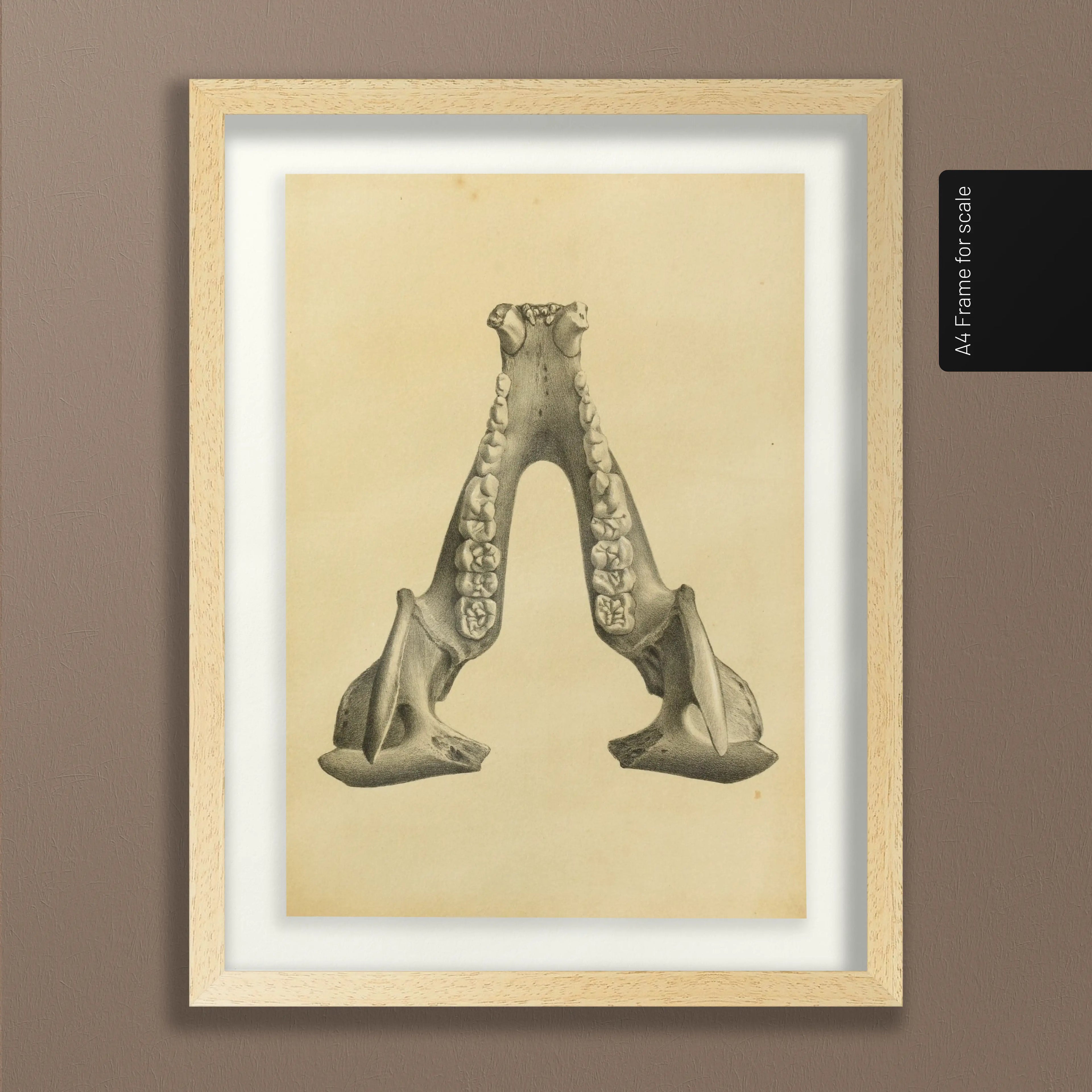 Anatomy: Plate No. 52