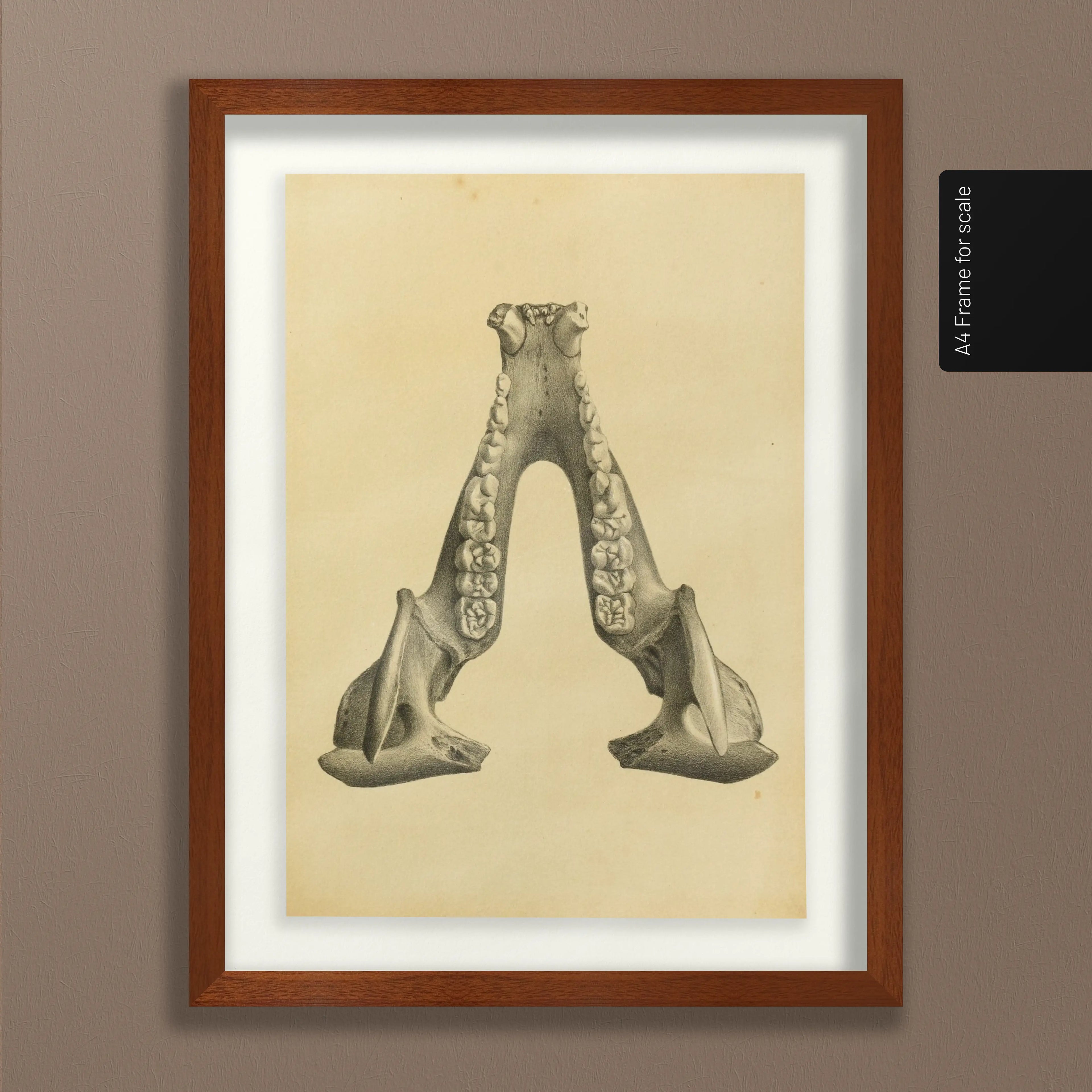 Anatomy: Plate No. 52