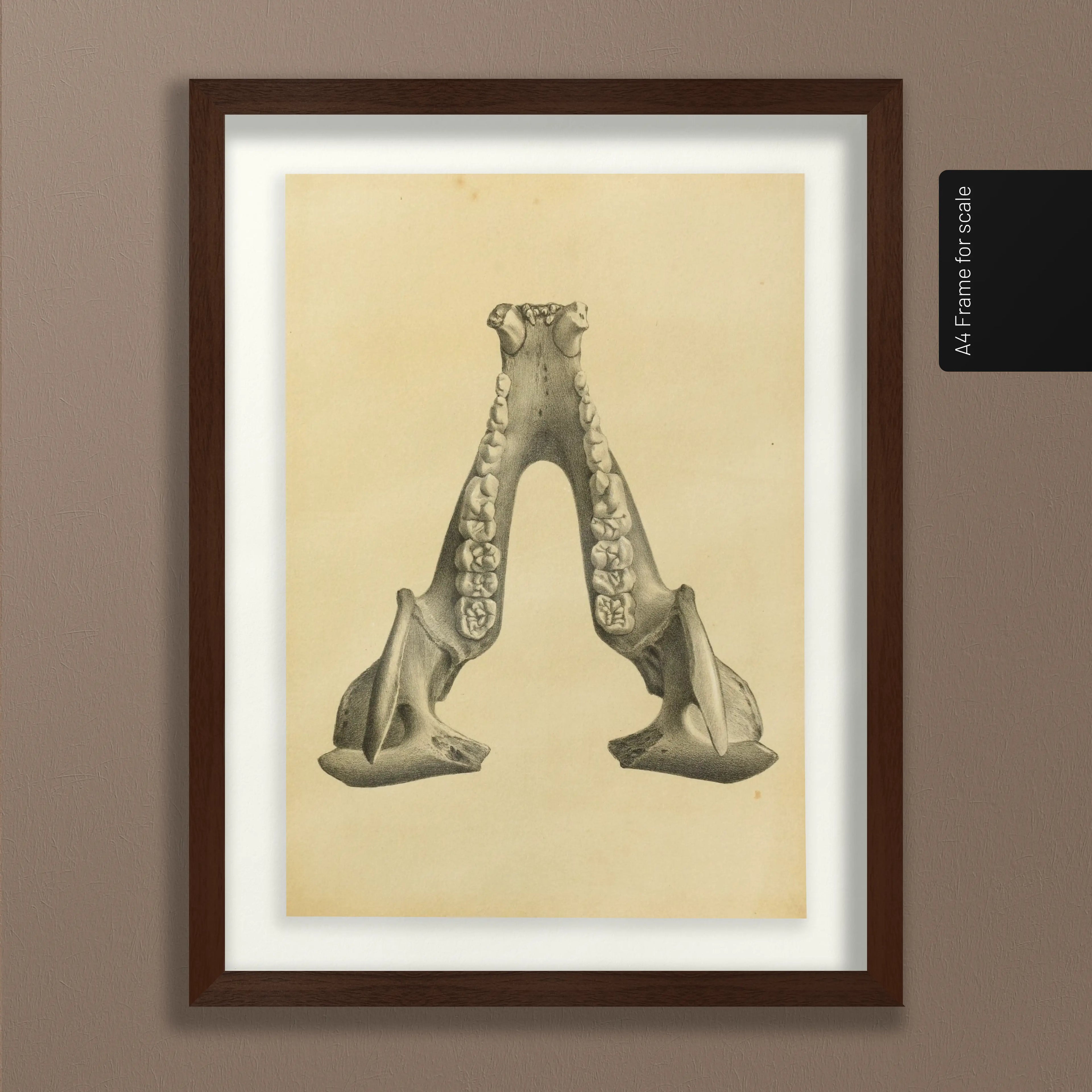 Anatomy: Plate No. 52